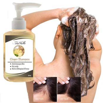 Ženšenis Plaukų Slinkimo Šampūnas Galingas Gydymo Esmė Žolės, Imbieras Aušintuvas Plaukų Augimą, Losjonai, Vyrams, Moterims
